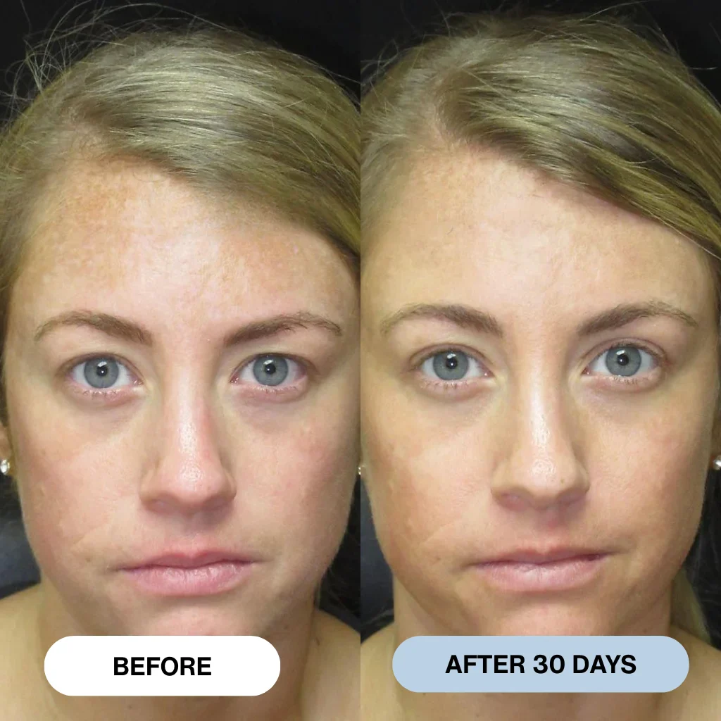 Ryte™ Copper Peptide Micro-Infusion System - Image 2
