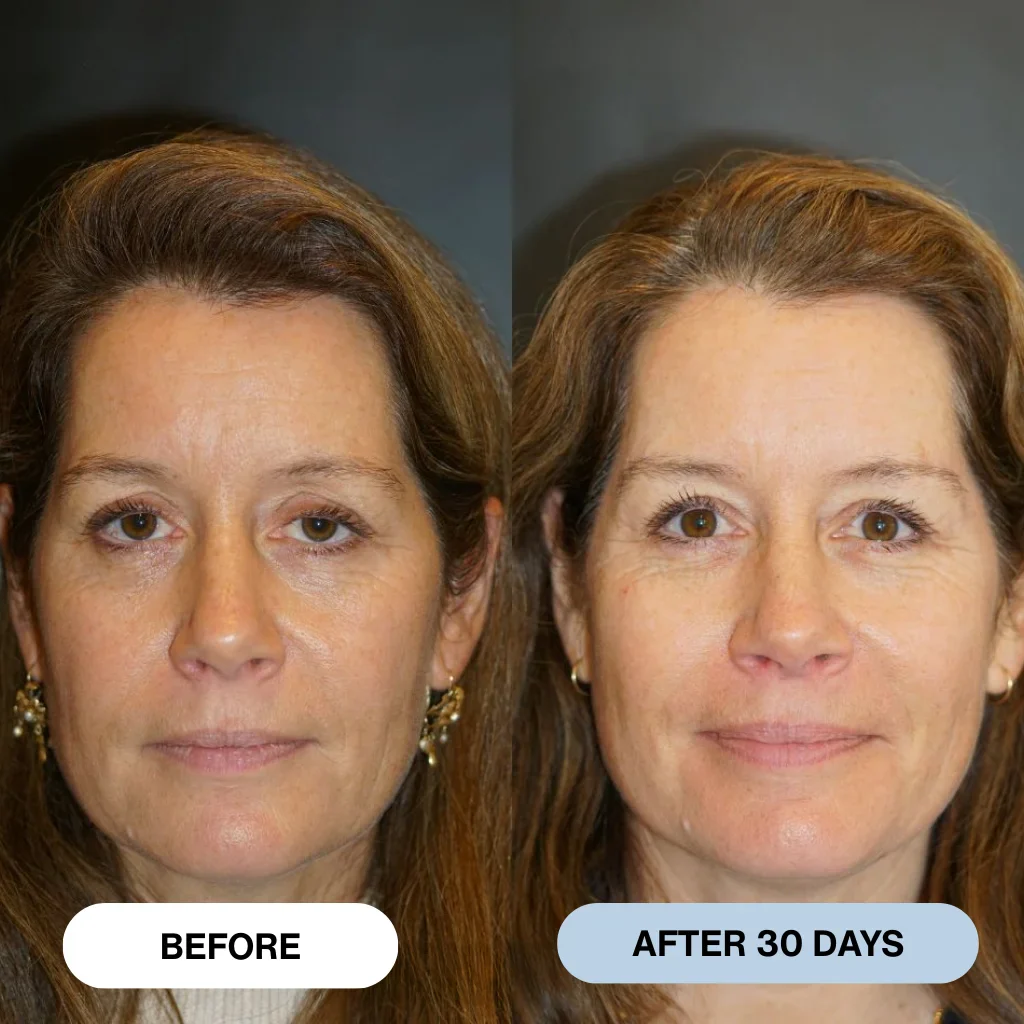 Ryte™ Copper Peptide Micro-Infusion System - Image 8