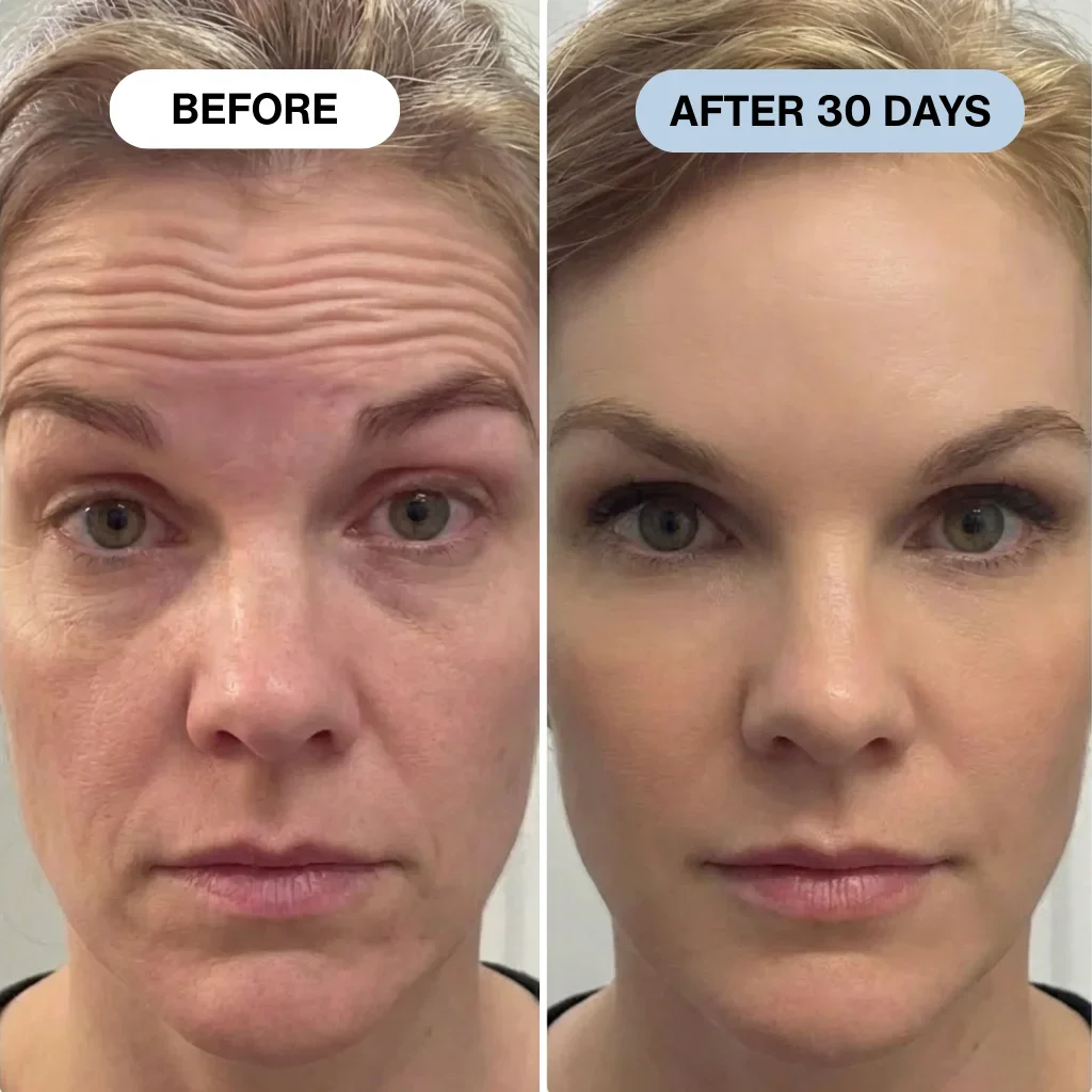 Ryte Copper Peptide Micro-Infusion System - Image 2