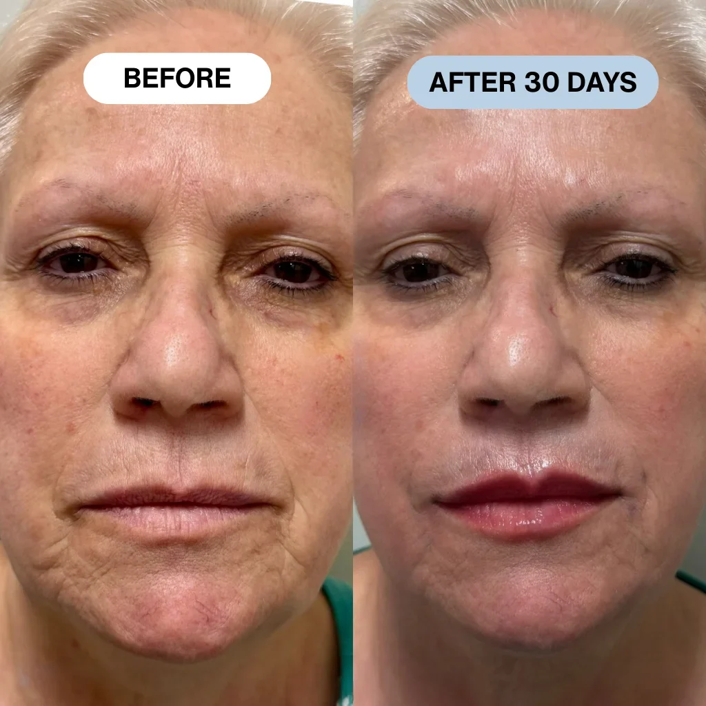 Ryte Copper Peptide Micro-Infusion System - Image 11
