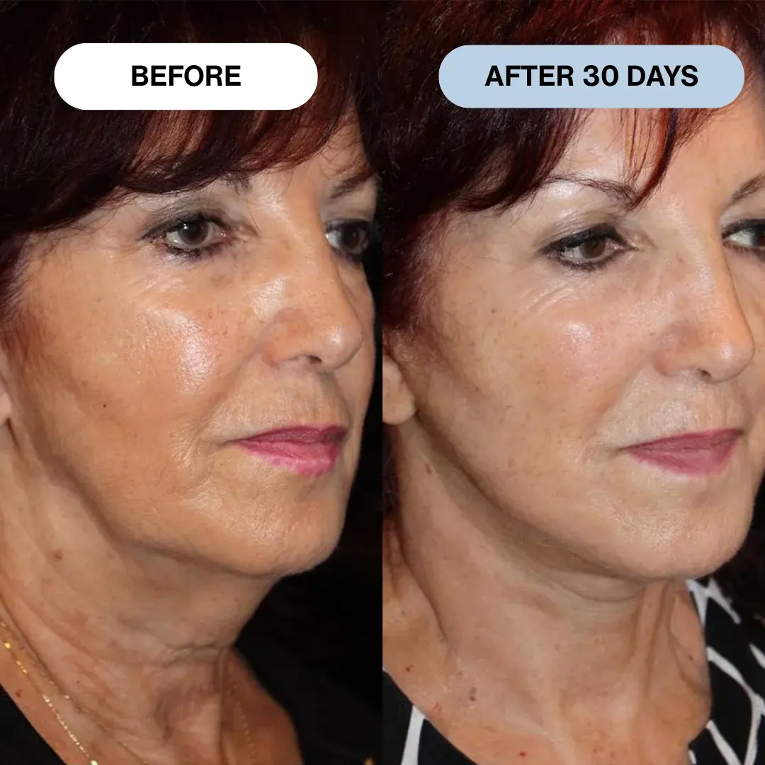 Ryte Copper Peptide Micro-Infusion System - Image 10