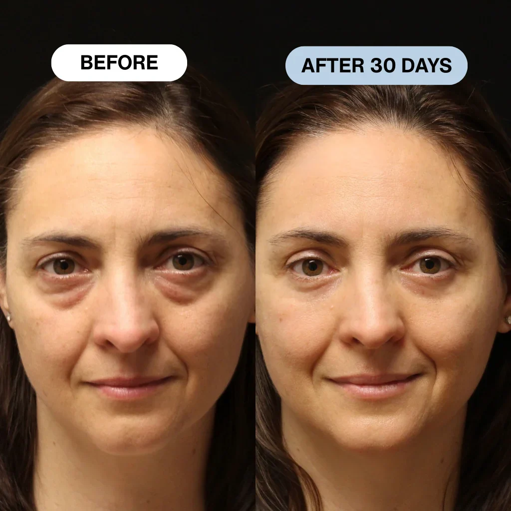 Ryte Copper Peptide Micro-Infusion System - Image 10
