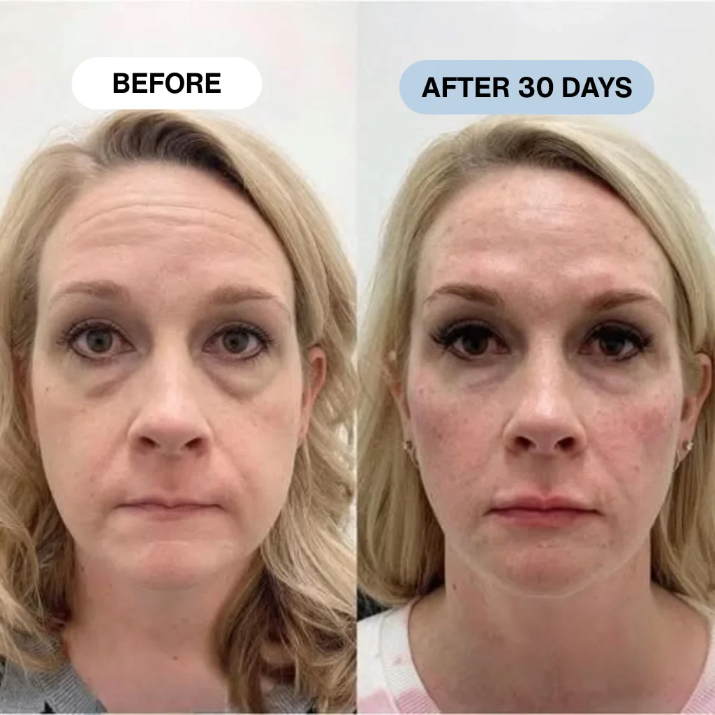 Ryte Copper Peptide Micro-Infusion System - Image 11