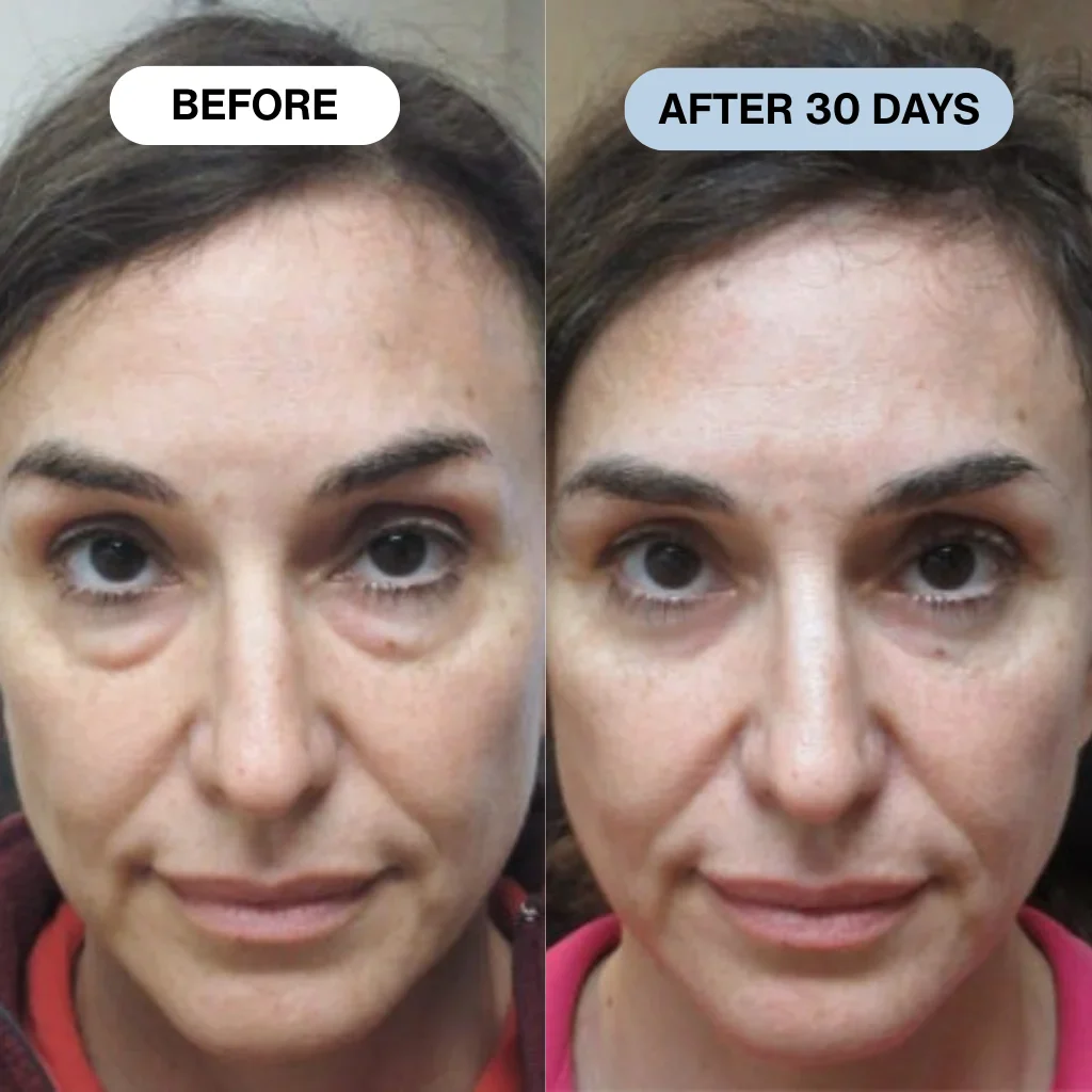 Ryte Copper Peptide Micro-Infusion System - Image 3